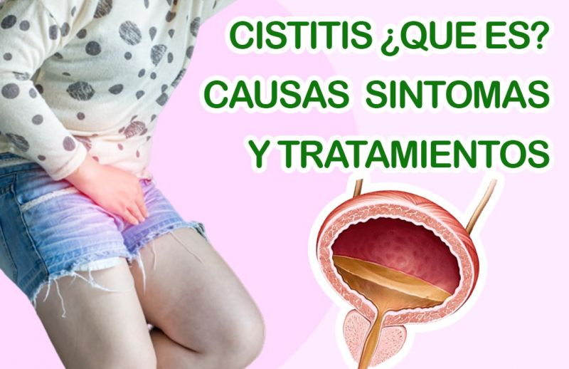 Cistitis Qu Es Causas S Ntomas Remedios Y Tratamiento Nuevas Evas