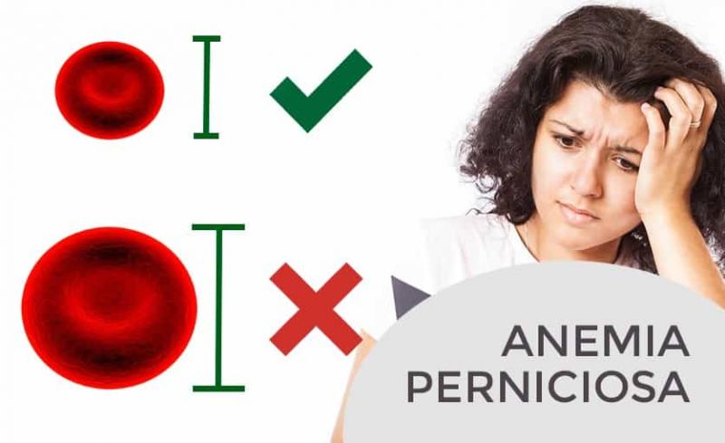 Anemia Perniciosa Qué Es Síntomas Causas Tratamiento Natural Nuevas Evas 8701