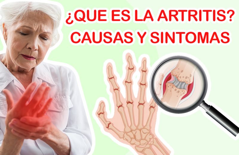 ¿qué Es La Artritis? Causas Y Síntomas 